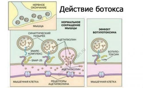 Сколько стоит процедура ботокса глазах Сколько стоит процедура ботокса глазах