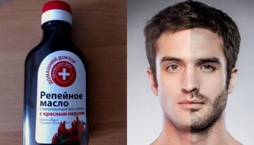 Можно ли использовать репейное масло для лица при сосудистой сетке на лице Можно ли использовать репейное масло для лица при сосудистой сетке на лице