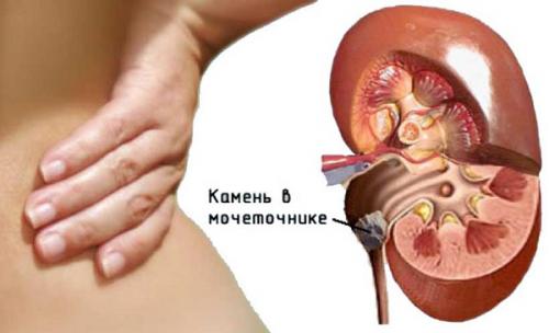 Как правильно очистить почки от кожицы. Как почистить почки народными средствами