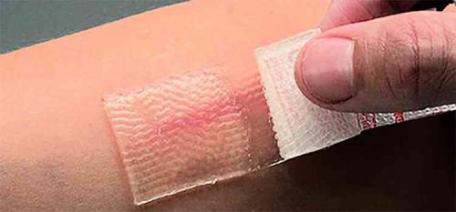 Галинзога четырехлучевая (американка). Использование лечебных свойств галинсога в медицине, польза или вред